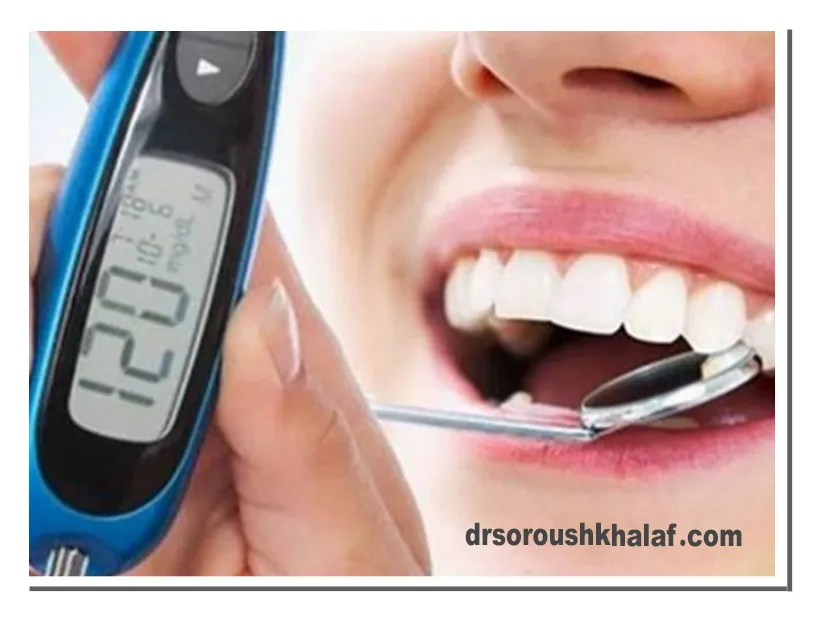 مراقبت های پیش از کاشت ایمپلنت برای افراد دیابتی