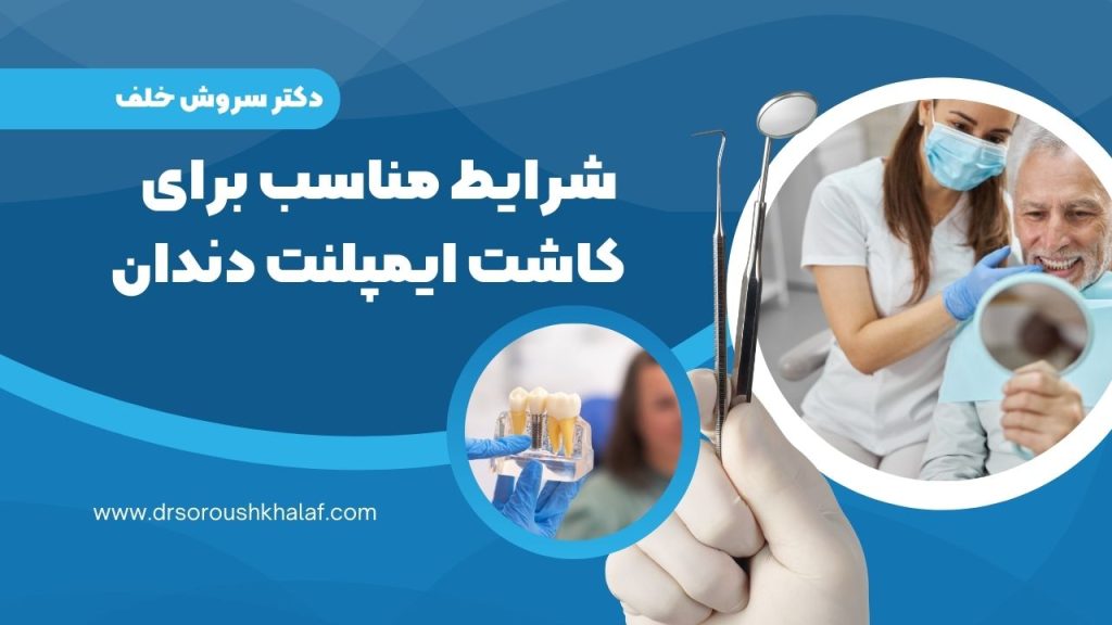 شرایط مناسب برای کاشت ایمپلنت