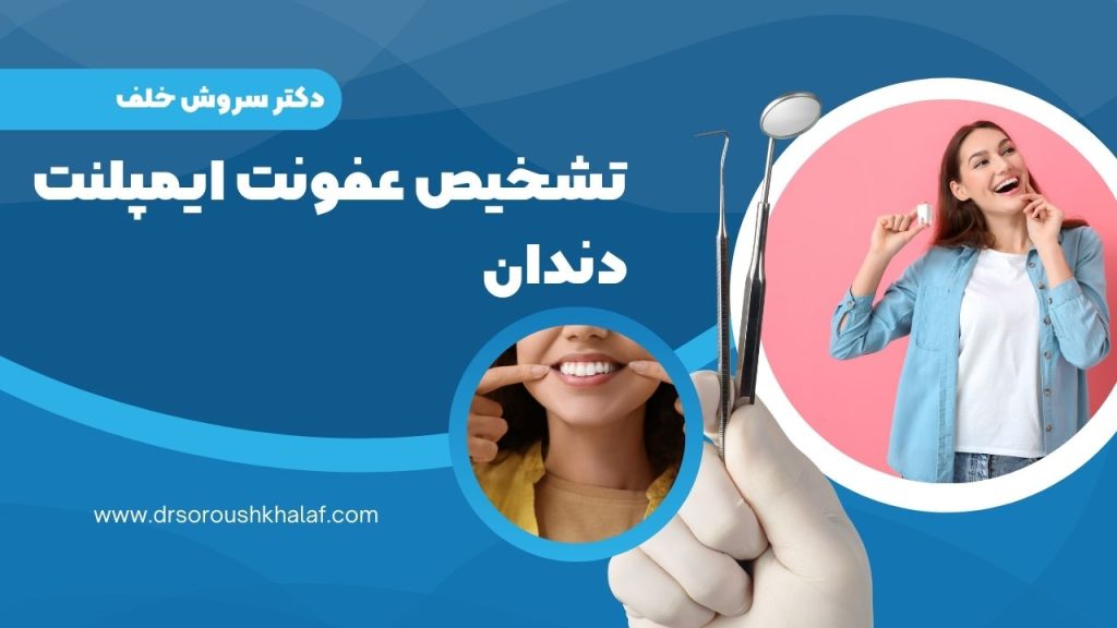 تشخیص عفونت ایمپلنت دندان