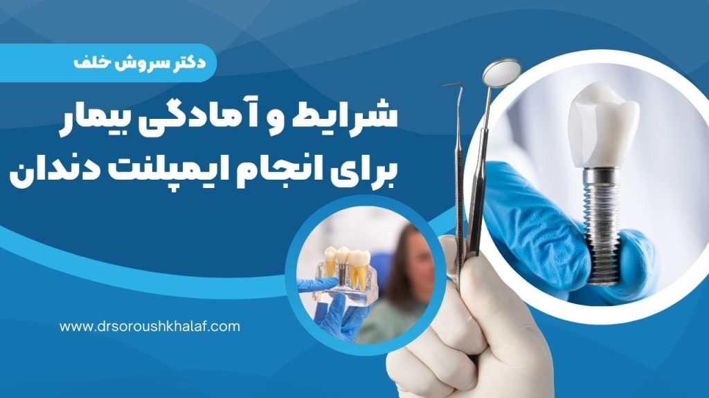 آمادگی بیمار برای انجام ایمپلنت