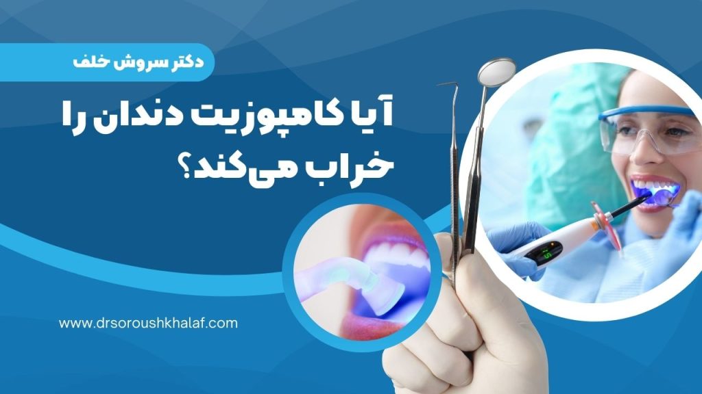 کامپوزیت دندان را خراب میکند