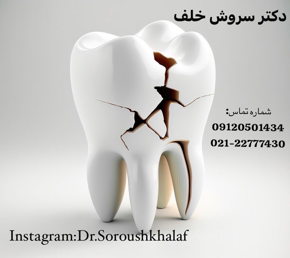 پوشش‌های زیست‌فعال برای افزایش عمر 22 ایمپلنت‌ها
