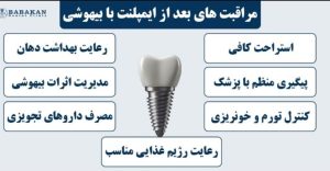 ایمپلنت با بیهوشی کامل