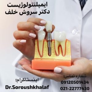 ایمپلنت در نزدیکی ریشه‌های باقی‌مانده