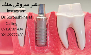 مشکلات اجتماعی افراد بی دندون 1 مشکلات اجتماعی افراد بی دندون