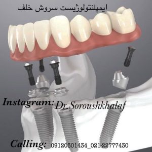 مشکلات اجتماعی افراد بی دندون 2 مشکلات اجتماعی افراد بی دندون