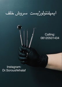 ایمپلنت برای فیکس کردن دندان 2 ایمپلنت برای فیکس کردن دندان