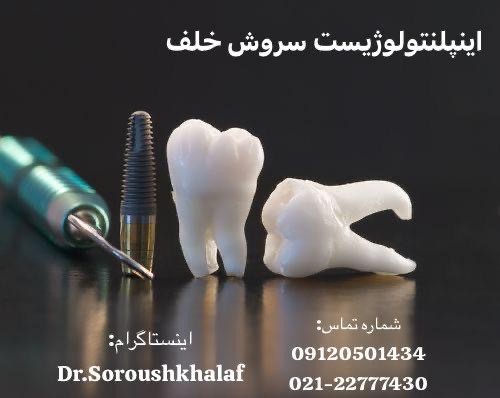 ایمپلنت در بیماران با تصادف فک