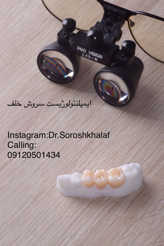 تحلیل سلامت لثه پیش از ایمپلنت