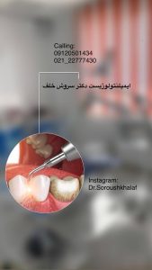 تحلیل سلامت لثه پیش از ایمپلنت
