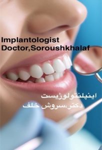 تعیین زاویه مناسب ایمپلنت 1 تعیین زاویه مناسب ایمپلنت