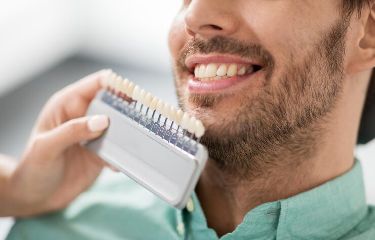 فرق ایمپلنت و لمینت چیست؟