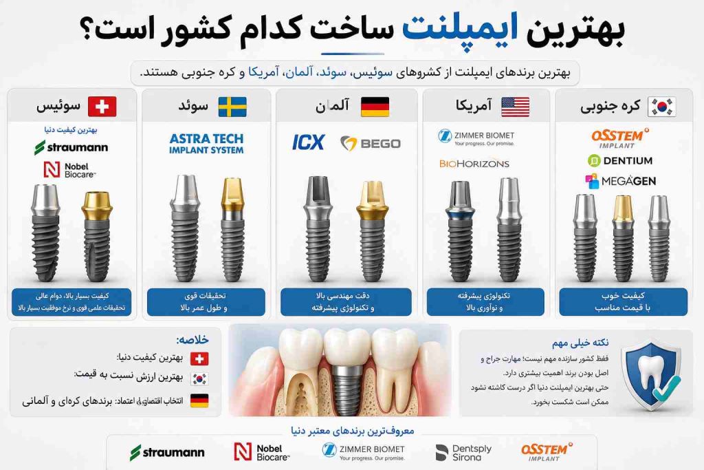 بهترین ایمپلنت ساخت کدام کشور است؟