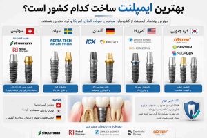 بهترین ایمپلنت ساخت کدام کشور است؟