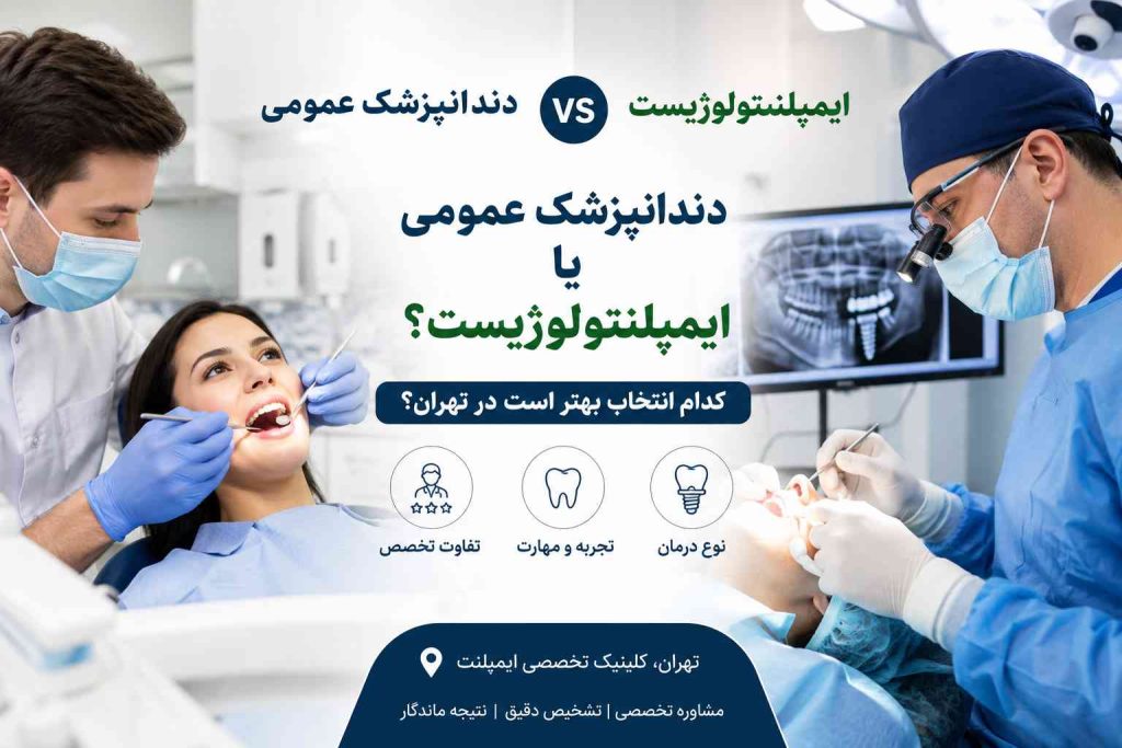 تفاوت دندانپزشک عمومی و متخصص ایمپلنتولوژیست در تهران