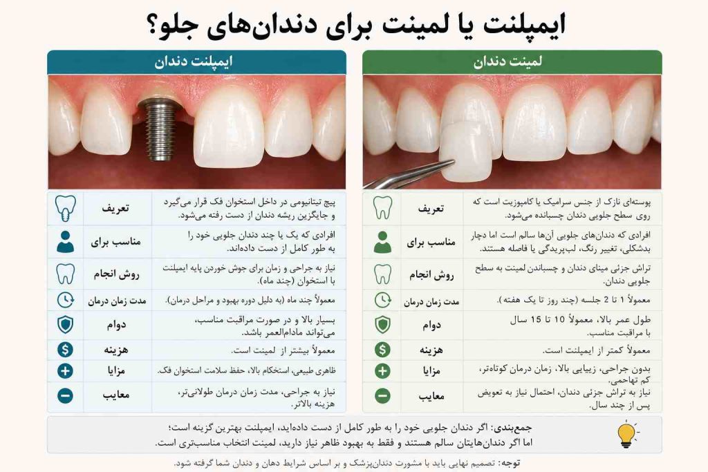 ایمپلنت یا لمینت: برای دندان جلو کدام انتخاب کنم؟