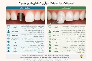 ایمپلنت یا لمینت: برای دندان جلو کدام انتخاب کنم؟