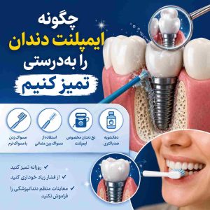 چگونه ایمپلنت دندان را به‌درستی تمیز کنیم