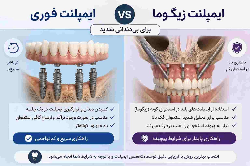 ایمپلنت فوری در تهران