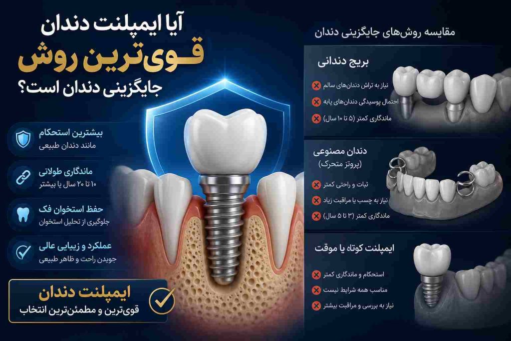 ایمپلنت فوری در تهران