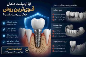ایمپلنت فوری در تهران