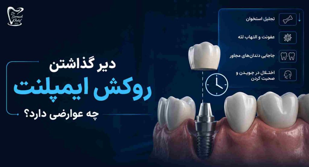 دیر گذاشتن روکش ایمپلنت؛ چه عوارضی دارد؟