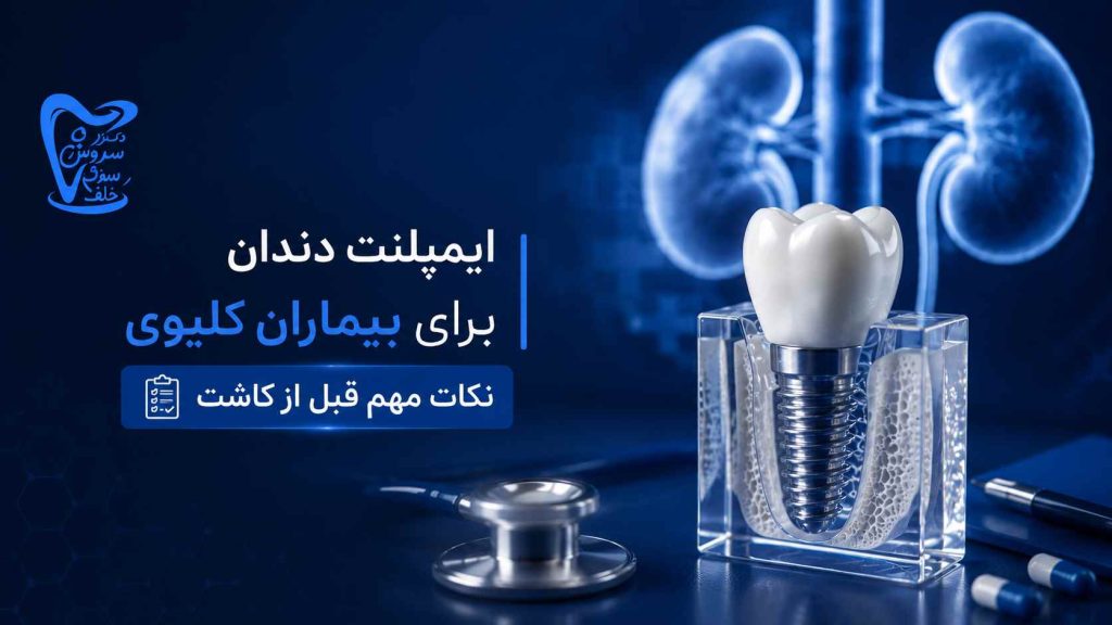 ایمپلنت فوری در تهران